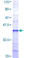 12.5% SDS-PAGE Stained with Coomassie Blue.